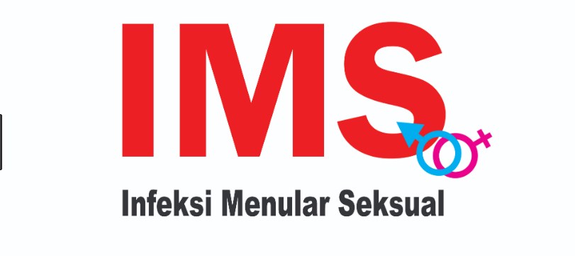 IMS