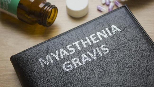 myasthenia gravis