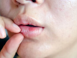 Bibir Kering Bikin Aktivitas Terganggu? Yuk, Coba 5 Tips Ampuh Ini!
