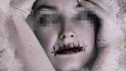 Wanita di Jepang Diduga Jahit Bibir Teman Serumah, Korban Kabur Minta Pertolongan
