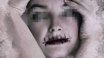 Wanita di Jepang Diduga Jahit Bibir Teman Serumah, Korban Kabur Minta Pertolongan